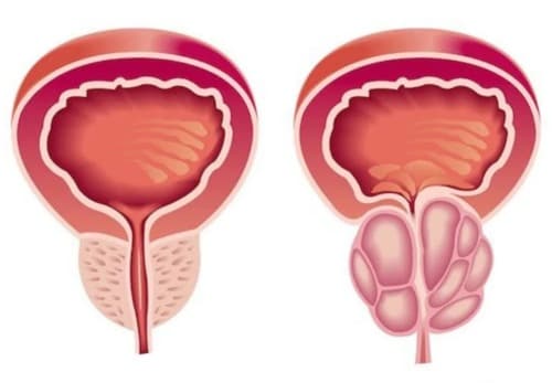 Revitaprost medicamento opiniones