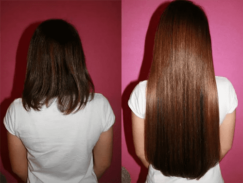 Minoxidil spray precio farmacia similares